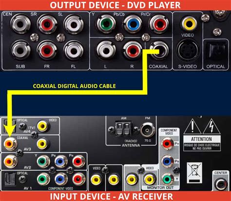 RCA vs. AUX: A Comprehensive Guide to Audio Connections