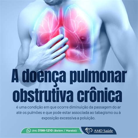 RIP CA: Um Guia Abrangente sobre a Doença Pulmonar Obstrutiva Crônica