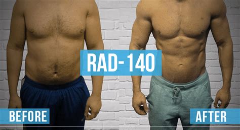 Rad140 Before and After: A Comprehensive Guide