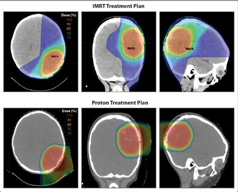 Radiation Therapy in Pediatric Oncology Kindle Editon