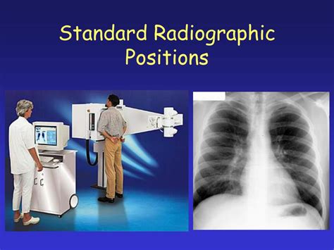 Radiographic Positioning PDF