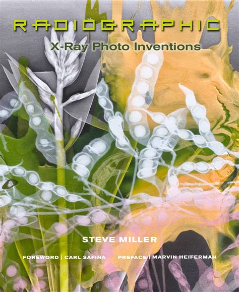 Radiographic X-Ray Photo Inventions Reader