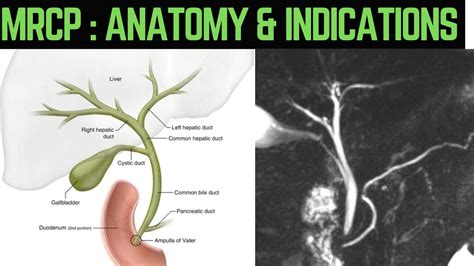 Radiology for the MRCP Reader