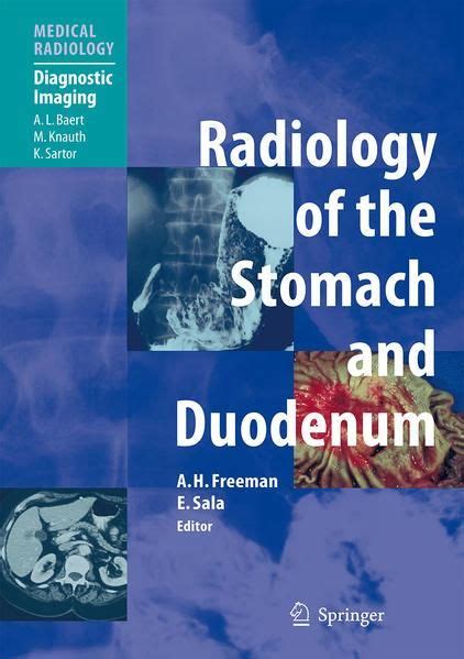 Radiology of the Stomach and Duodenum Kindle Editon