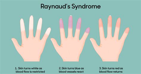 Raynare's Appearance and Personality