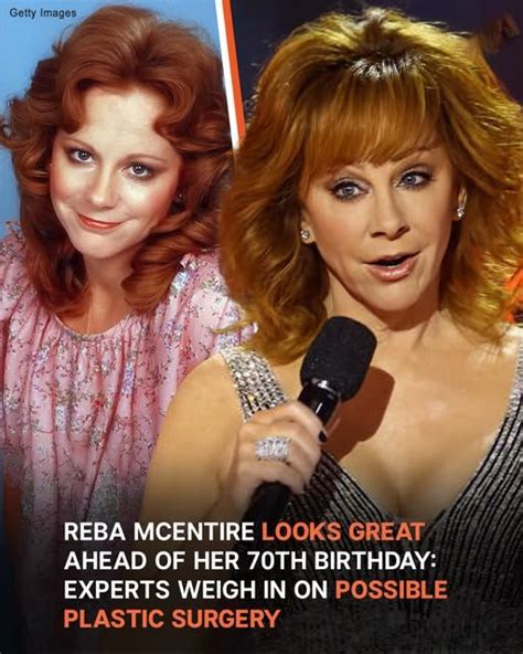 Reba McEntire Face Surgery: The Truth About Her Changing Appearance