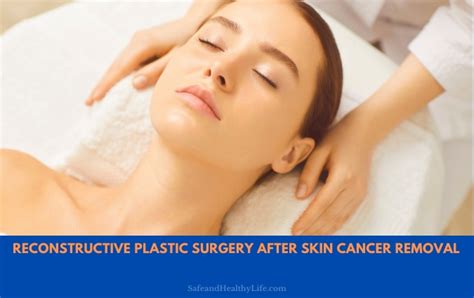 Reconstructive Plastic Surgery for Cancer Epub