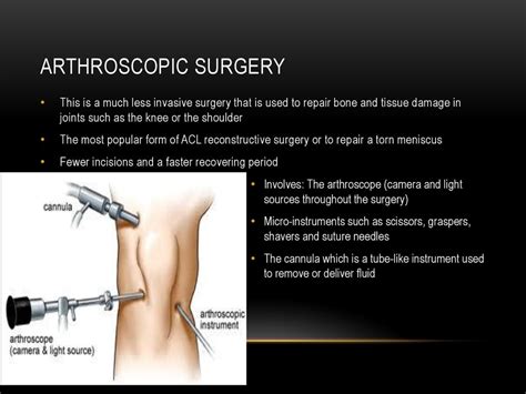 Reconstructive Surgery of the Joints PDF