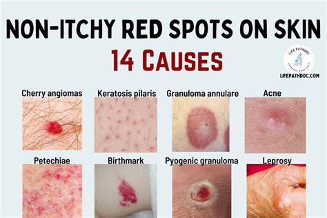 Red Patches on Skin Not Itchy: 5 Common Causes