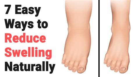 Reduce swelling: