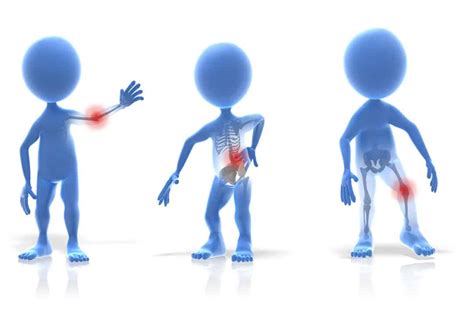 Reduced Musculoskeletal Disorders (MSDs):