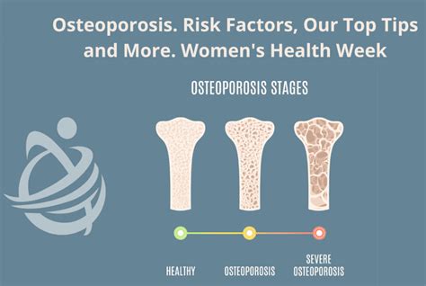 Reduced risk of osteoporosis: