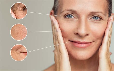 Reduced wrinkles and fine lines