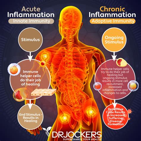 Reducing inflammation