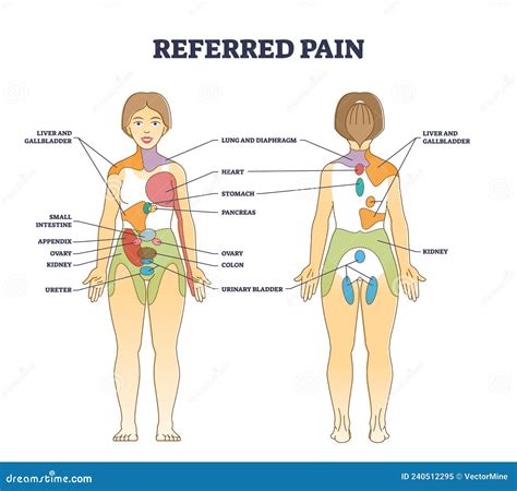 Referred Pain Chart
