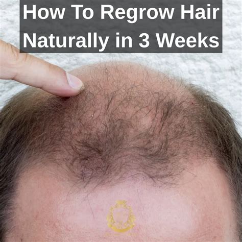 Regrow Hair Naturally in 3 Weeks: Your 2025 Hair Growth Plan