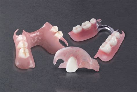 Removable: