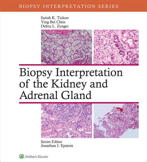 Renal Biopsy Interpretation Ebook Reader