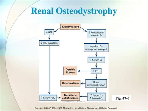 Renal Osteodystrophy Doc