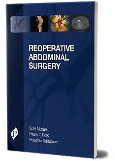 Reoperative Abdominal Surgery Ebook Doc