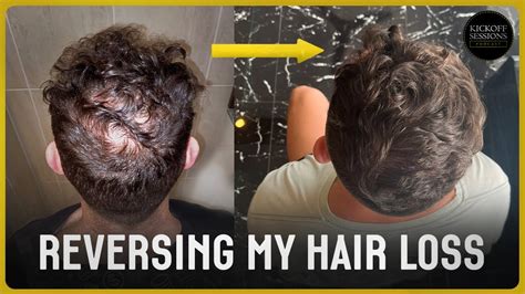 Reversible Hair Transformation: