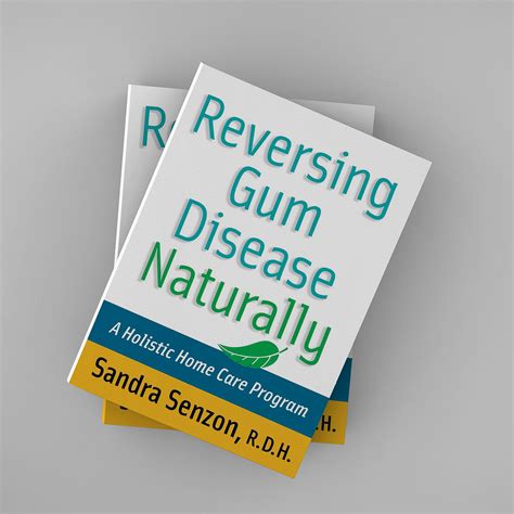 Reversing Gum Disease Naturally: A Holistic Home Care Program Kindle Editon