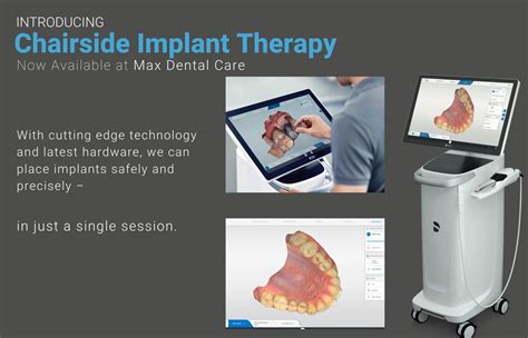 Revolutionizing Dentistry with Drills3D: Precision, Efficiency, and Advanced Technology