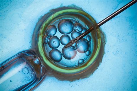 Rhea Fertility: 5 Key Innovations Transforming Assisted Reproductive Technologies