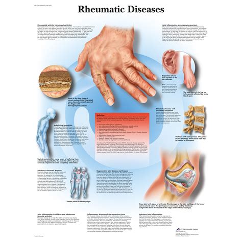 Rheumatic Disorders Doc