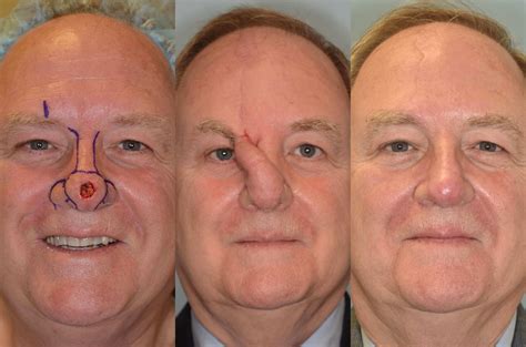 Rhinology and Facial Plastic Surgery PDF