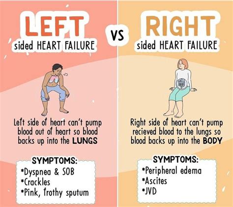 Right Sided vs. Left Sided Heart Failure: A Comprehensive Guide