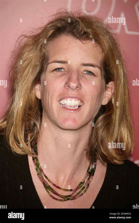 Rory Kennedy Teeth Before and After: A Journey of Transformation