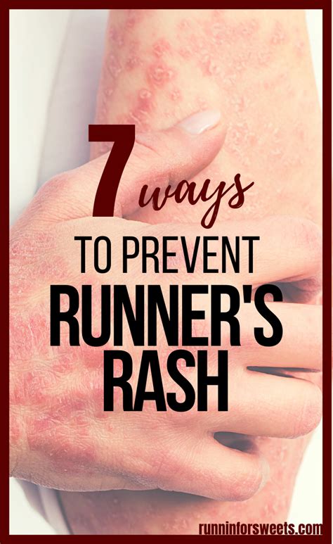 Runners Rash: Prevention, Treatment, and All You Need to Know