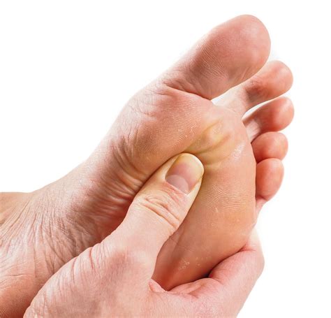 Salice Rose Feet: A Comprehensive Guide to Understanding and Treating Metatarsalgia