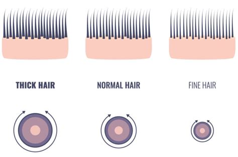 Scalp Thickness: A Distinctive Characteristic