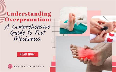 Scaramouche Feet: A Comprehensive Guide to Understanding and Treating This Condition