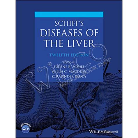 Schiff's Diseases of the Li Epub