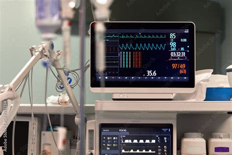 Screening Machine: The Heartbeat of Modern Industries