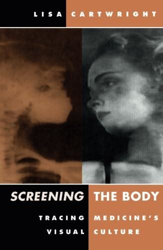 Screening The Body Tracing Medicine s Visual Culture PDF