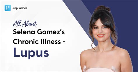 Selena Gomez's Lupus Journey: A Guide to Symptoms, Treatment, and Inspiration