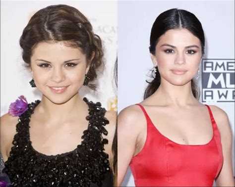 Selena Gomez Breast Augmentation: A Comprehensive Guide