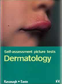 Self Assessment Picture Tests Dermatology Kindle Editon