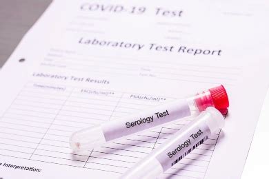 Serology Test Singapore Price: $80