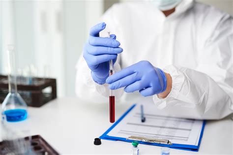 Serology Test Singapore Price: Affordable and Accurate Testing Options