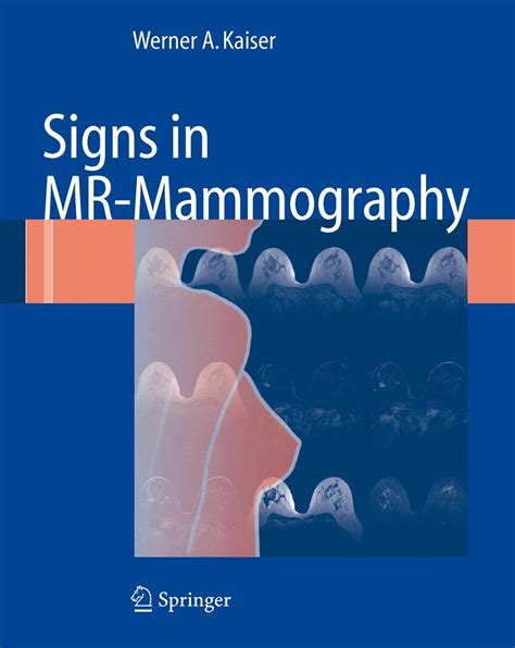 Signs in MR-Mammography 1st Edition Reader