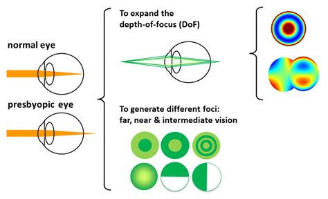 Simultaneous vision lenses: