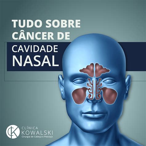 Sinais e Sintomas: Identificando o Câncer Nasal Precocemente