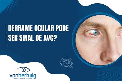 Sintomas de AVC Ocular: Um Guia Abrangente para Detectar e Agir