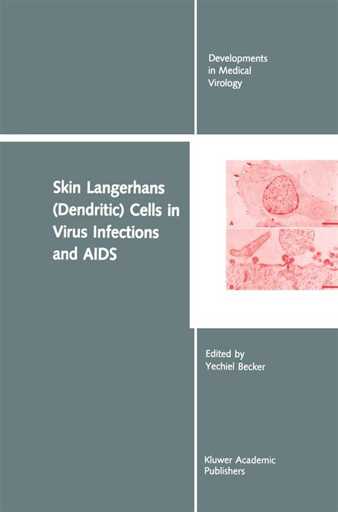 Skin Langerhans (Dendritic) Cells in Virus Infections and AIDS Kindle Editon