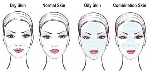 Skin type